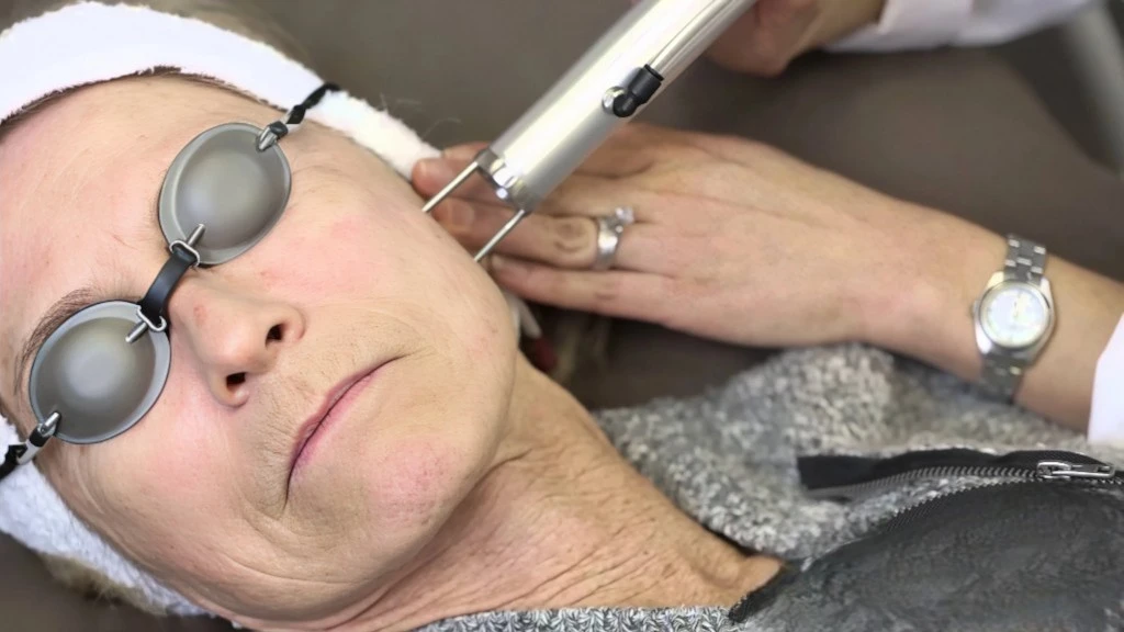 Rejuvenecimiento facial con láser híbrido