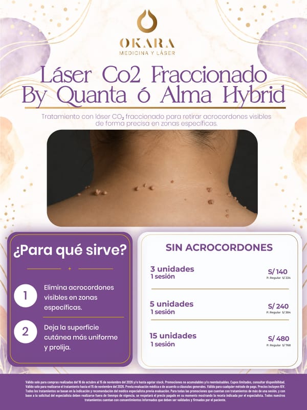Promoción de Okara — foto 3 de 10