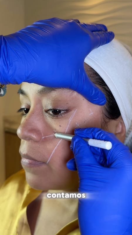 ✨ ¡La armonía facial comienza respetando tu esencia! 💖

Con ácido hialurónico e