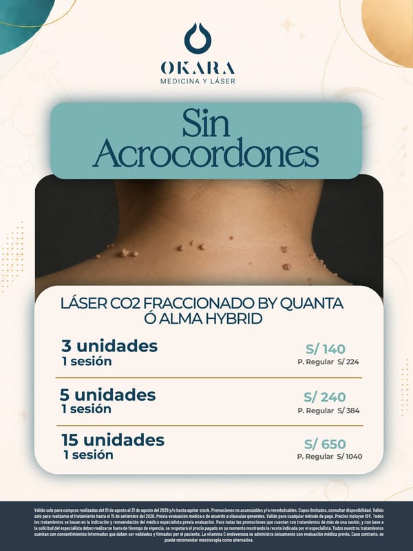 Promoción de Okara — foto 8 de 10