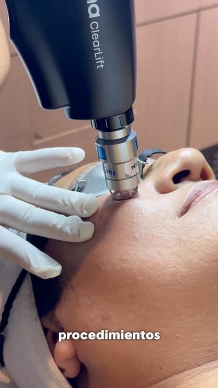 ✨ ¡Recupera la firmeza y definición de tu rostro!

¿Notas que tu piel ha perdido