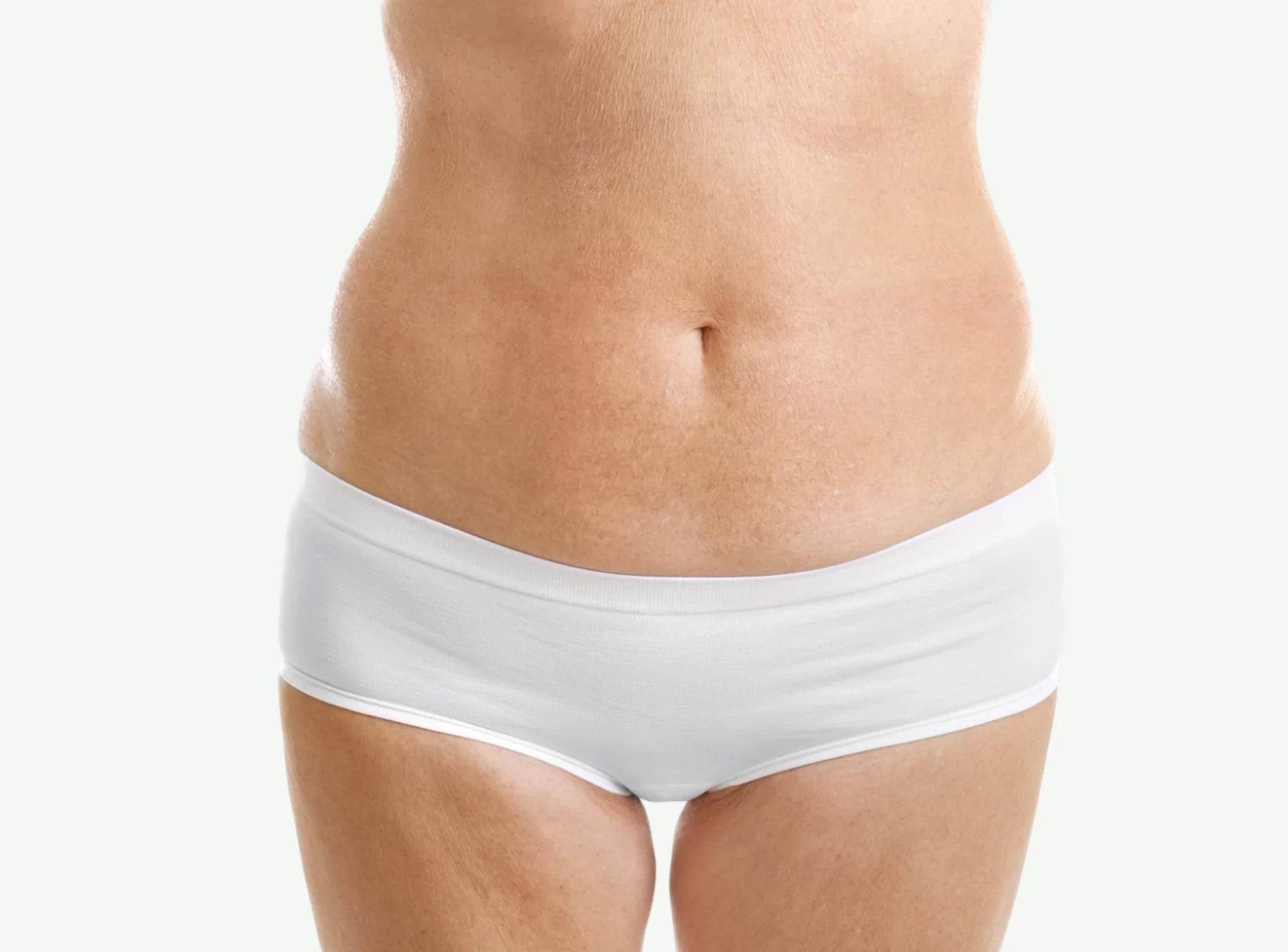 Mesoterapia Corporal — Antes