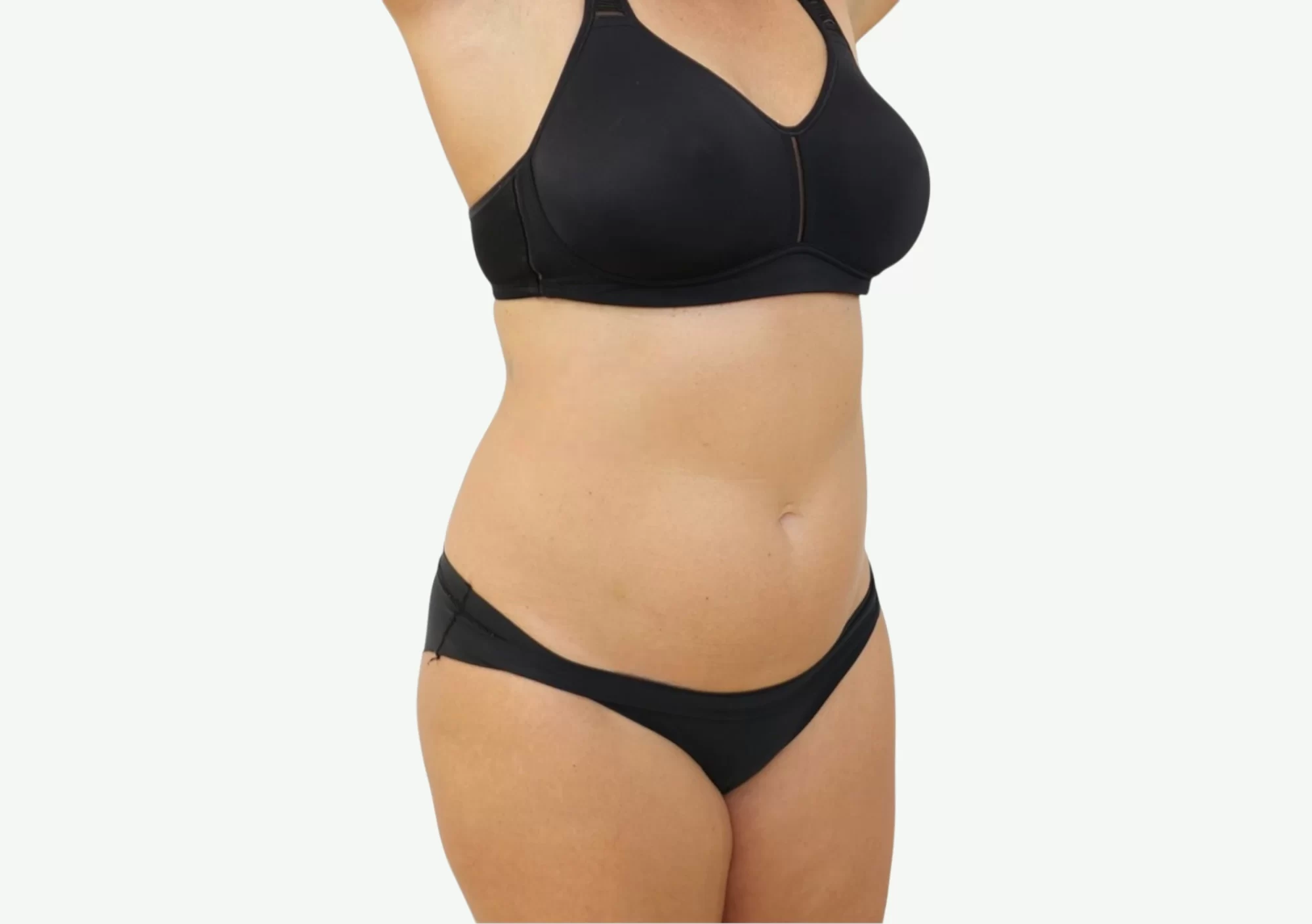 Smart Body Fit · Electroestimulación — Antes