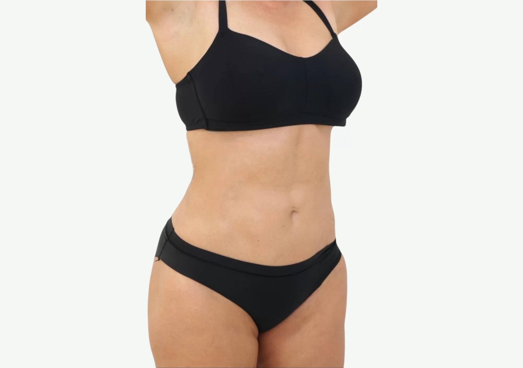 Smart Body Fit · Electroestimulación — Después