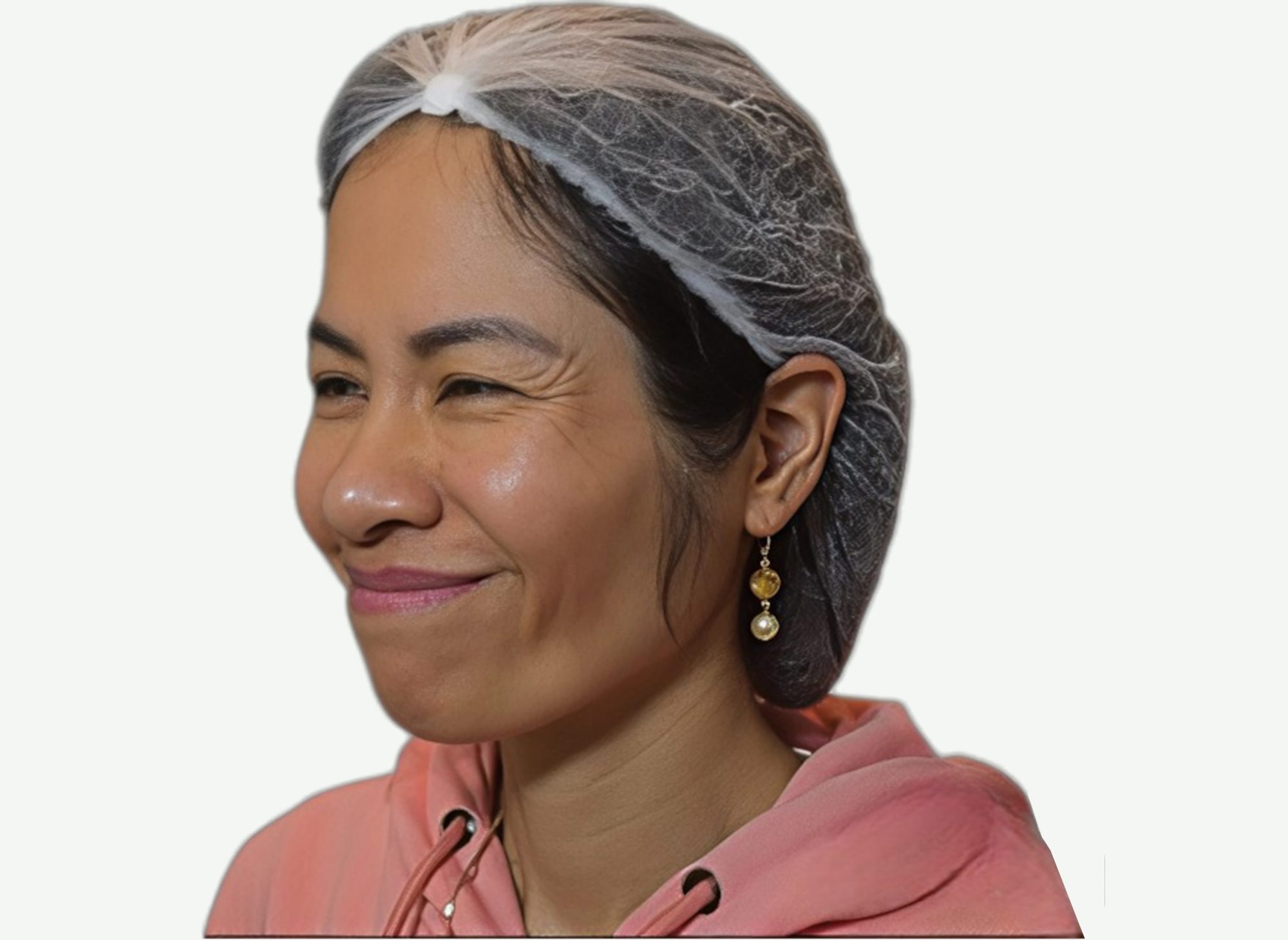 Toxina Botulínica — Antes