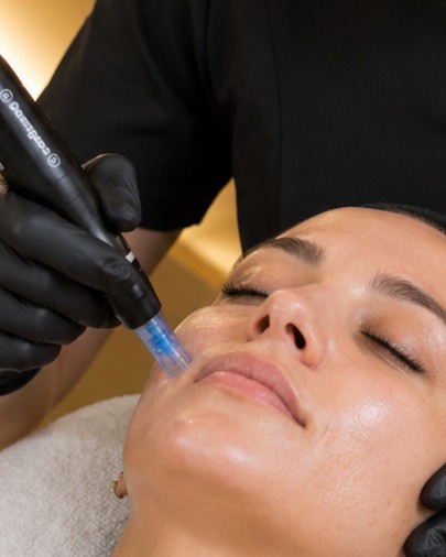 Dermapen · Microneedling